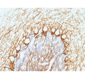 Immunohistochemistry - Anti-Neurofilament Heavy Polypeptide Antibody [NE14] (A249491) - Antibodies.com