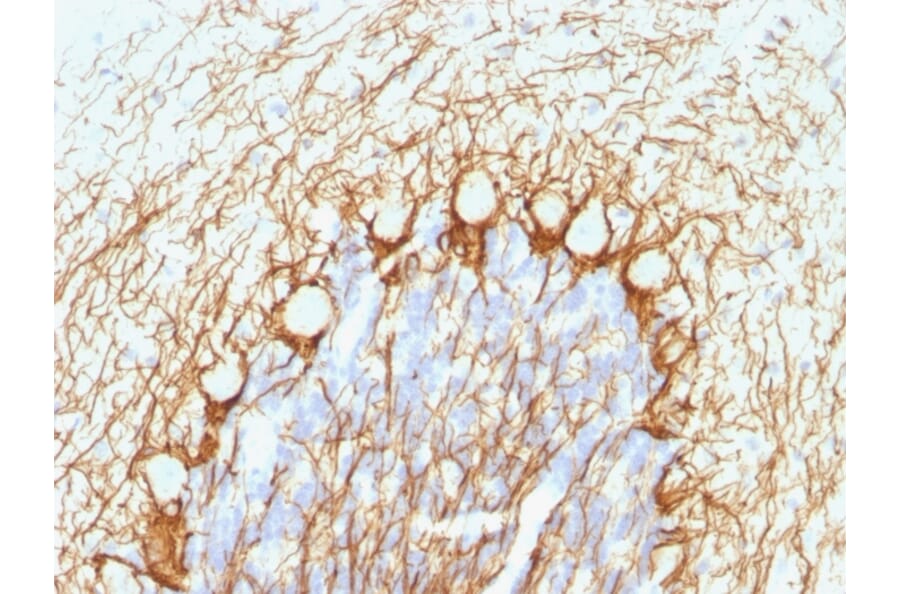 Immunohistochemistry - Anti-Neurofilament Heavy Polypeptide Antibody [NE14] (A249491) - Antibodies.com