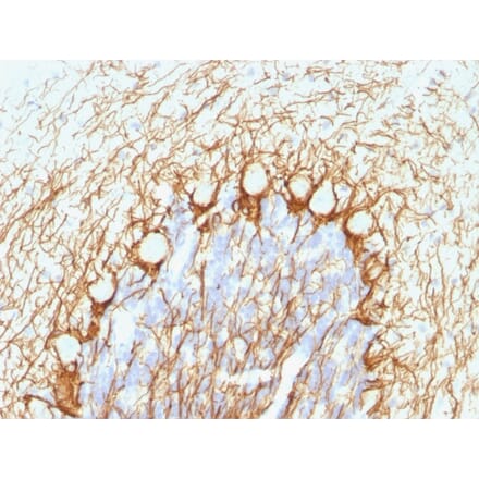 Immunohistochemistry - Anti-Neurofilament Heavy Polypeptide Antibody [NE14] (A249491) - Antibodies.com