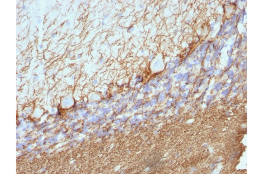 Immunohistochemistry - Anti-Neurofilament Heavy Polypeptide Antibody [NE14] (A249491) - Antibodies.com