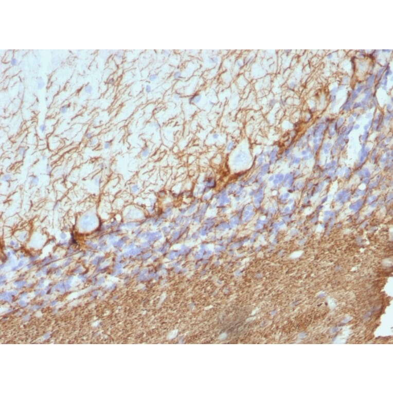 Immunohistochemistry - Anti-Neurofilament Heavy Polypeptide Antibody [NE14] (A249491) - Antibodies.com