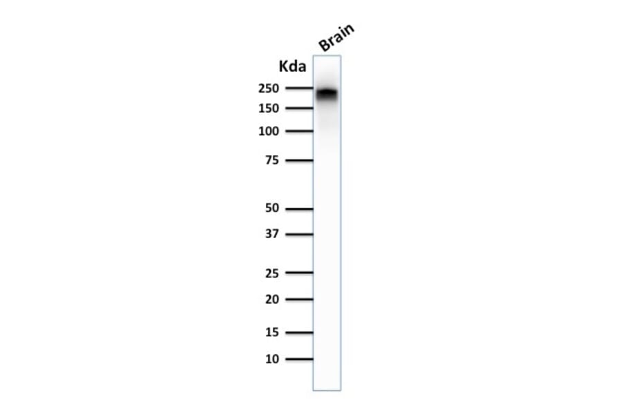 Western Blot - Anti-Neurofilament Heavy Polypeptide Antibody [NE14] (A249491) - Antibodies.com