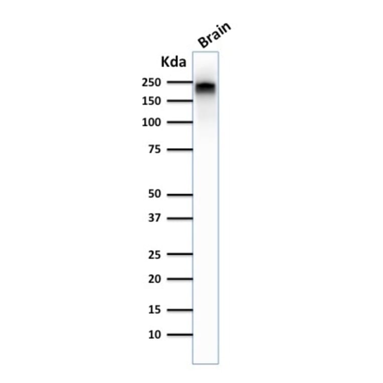 Western Blot - Anti-Neurofilament Heavy Polypeptide Antibody [NE14] (A249491) - Antibodies.com