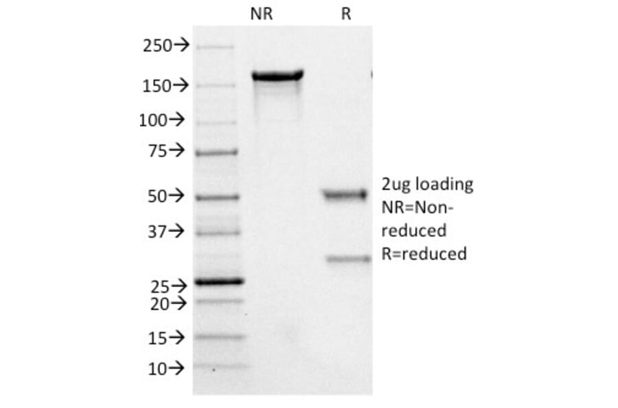 SDS-PAGE - Anti-Neurofilament Heavy Polypeptide Antibody [NE14] (A249491) - Antibodies.com