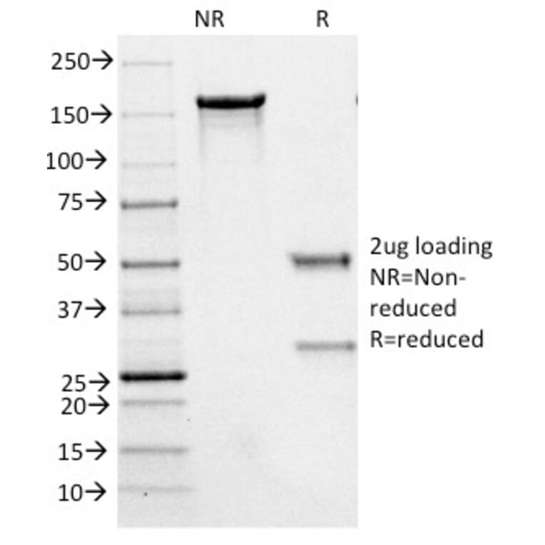 SDS-PAGE - Anti-Neurofilament Heavy Polypeptide Antibody [NE14] (A249491) - Antibodies.com