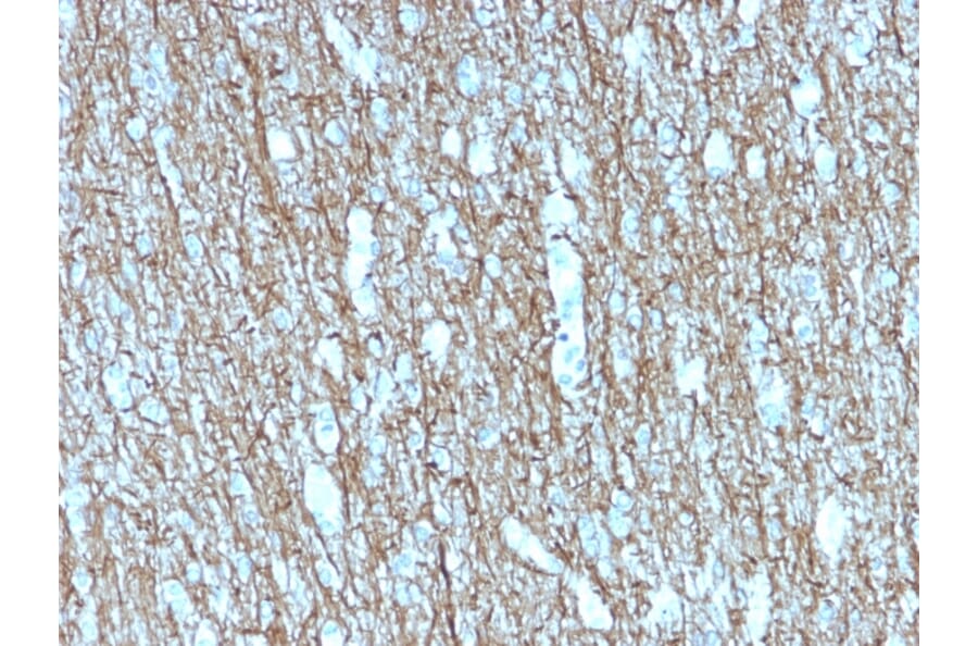 Immunohistochemistry - Anti-Neurofilament Heavy Polypeptide Antibody [rNF421] (A249492) - Antibodies.com
