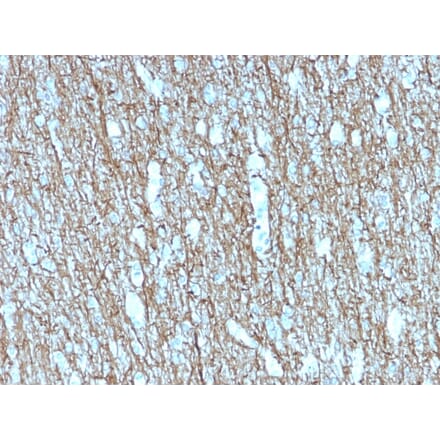 Immunohistochemistry - Anti-Neurofilament Heavy Polypeptide Antibody [rNF421] (A249492) - Antibodies.com