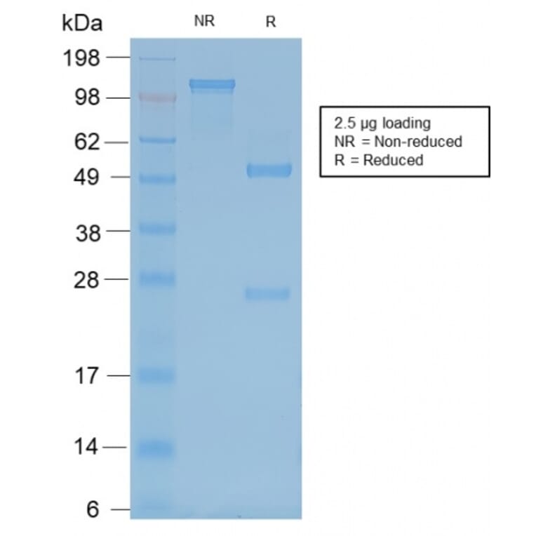 SDS-PAGE - Anti-Neurofilament Heavy Polypeptide Antibody [rNF421] (A249492) - Antibodies.com