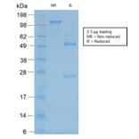 SDS-PAGE - Anti-Neurofilament Heavy Polypeptide Antibody [rNF421] (A249492) - Antibodies.com