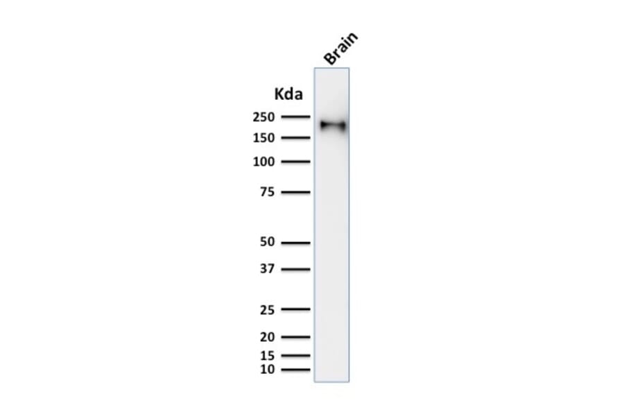 Western Blot - Anti-Neurofilament Heavy Polypeptide Antibody [rNF421] (A249492) - Antibodies.com