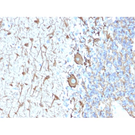 Immunohistochemistry - Anti-Neurofilament Heavy Polypeptide Antibody [NEFL.H/2324R] (A249493) - Antibodies.com