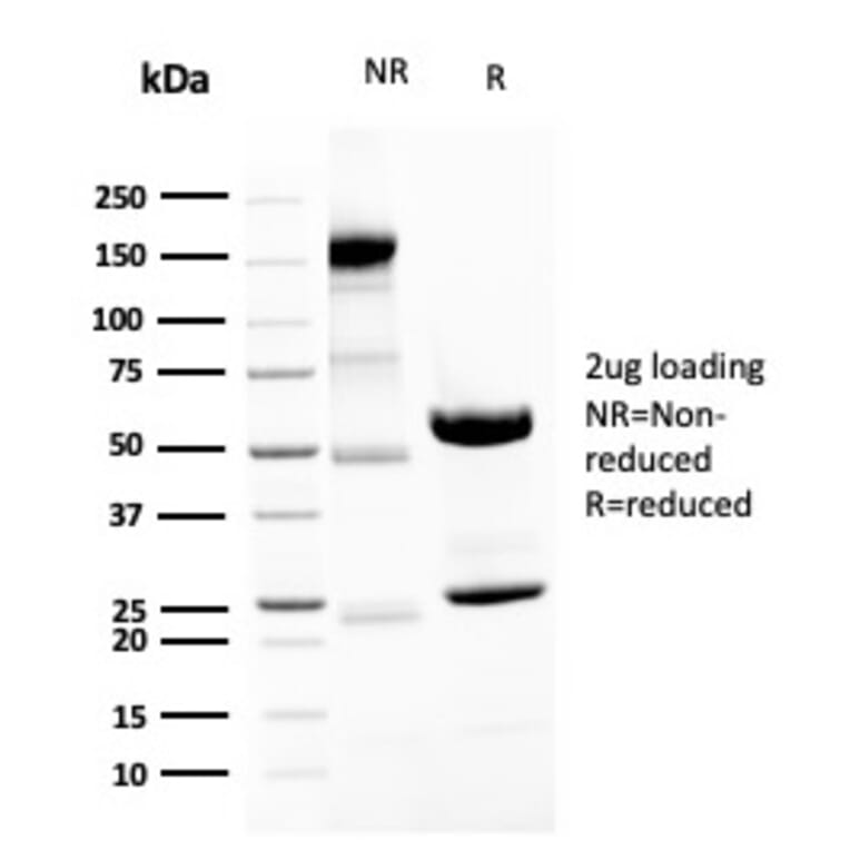 SDS-PAGE - Anti-Neurofilament Heavy Polypeptide Antibody [NEFL.H/2324R] (A249493) - Antibodies.com