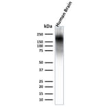 Western Blot - Anti-Neurofilament Heavy Polypeptide Antibody [NEFL.H/2324R] (A249493) - Antibodies.com