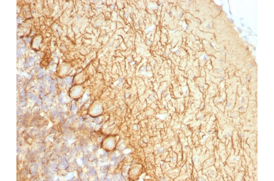 Immunohistochemistry - Anti-NF-L Antibody [NR-4] (A249494) - Antibodies.com