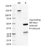 SDS-PAGE - Anti-NF-L Antibody [NR-4] (A249494) - Antibodies.com