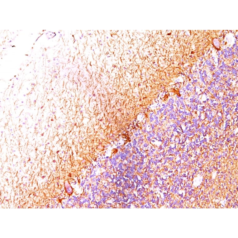 Immunohistochemistry - Anti-NF-L Antibody [SPM204] (A249494) - Antibodies.com