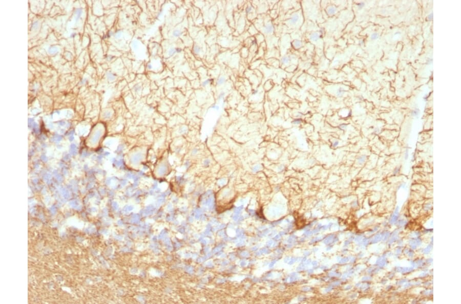 Immunohistochemistry - Anti-NF-L Antibody [NFL/736] (A249496) - Antibodies.com