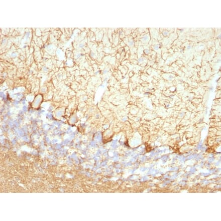 Immunohistochemistry - Anti-NF-L Antibody [NFL/736] (A249496) - Antibodies.com