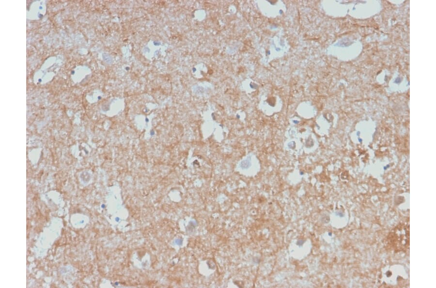 Immunohistochemistry - Anti-NF-L Antibody [NEFL/2983R] (A249496) - Antibodies.com