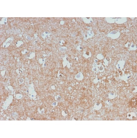 Immunohistochemistry - Anti-NF-L Antibody [NEFL/2983R] (A249496) - Antibodies.com