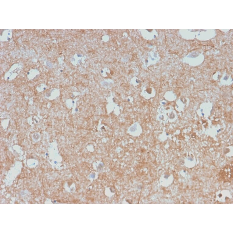 Immunohistochemistry - Anti-NF-L Antibody [NEFL/2983R] (A249496) - Antibodies.com