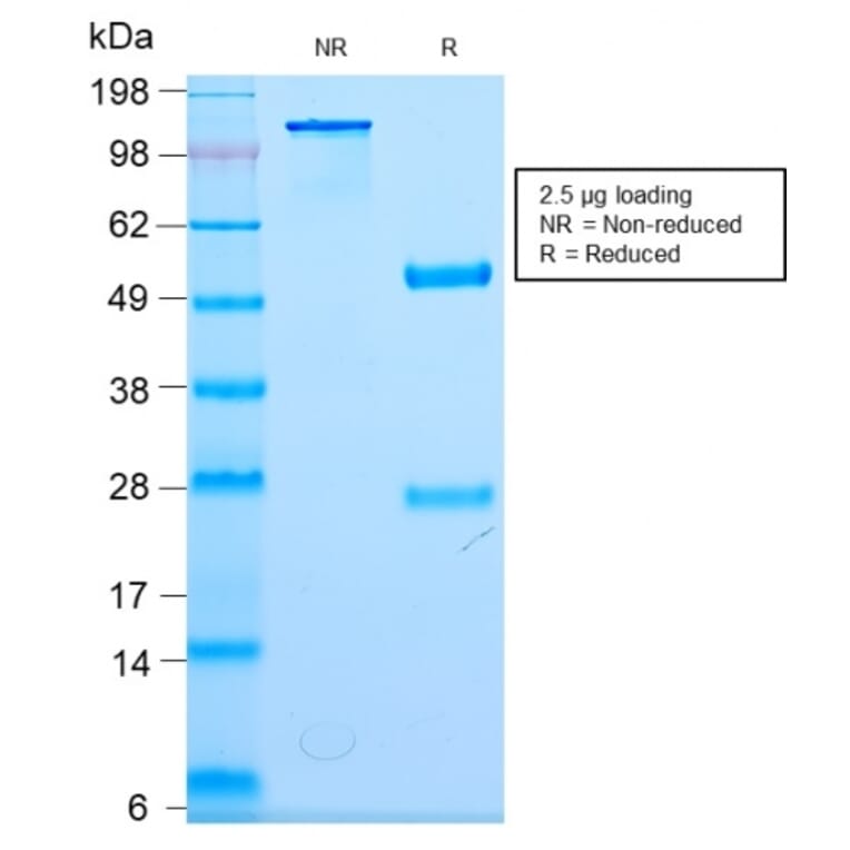 SDS-PAGE - Anti-NF-L Antibody [NEFL/2983R] (A249497) - Antibodies.com
