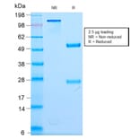 SDS-PAGE - Anti-NF-L Antibody [NEFL/2983R] (A249497) - Antibodies.com