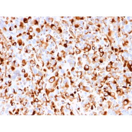 Immunohistochemistry - Anti-p75 NGF Receptor Antibody [rNGFR/1965] (A249498) - Antibodies.com
