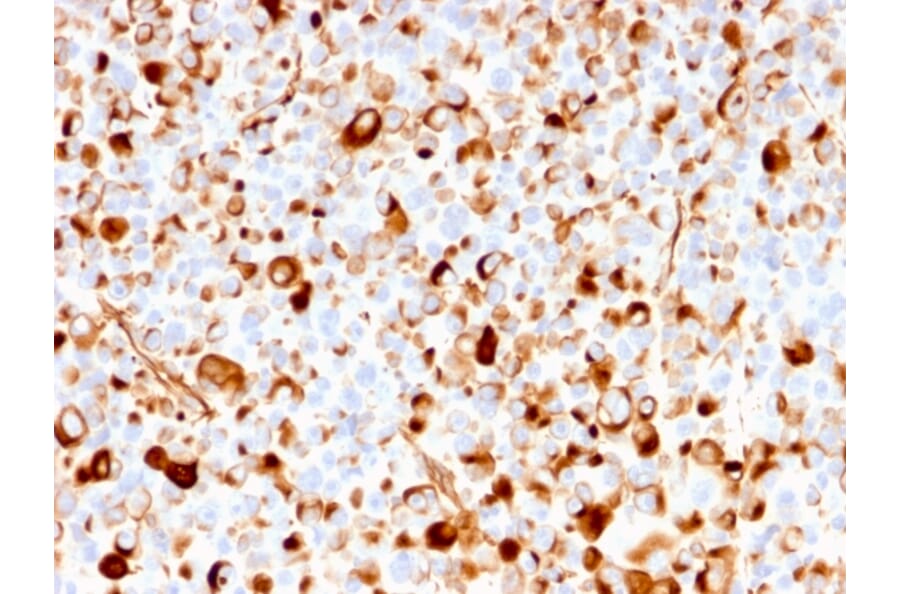 Immunohistochemistry - Anti-p75 NGF Receptor Antibody [rNGFR/1965] (A249497) - Antibodies.com