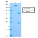 SDS-PAGE - Anti-p75 NGF Receptor Antibody [rNGFR/1965] (A249498) - Antibodies.com