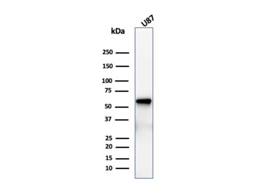 Western Blot - Anti-p75 NGF Receptor Antibody [rNGFR/1965] (A249498) - Antibodies.com