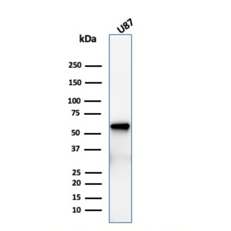 Western Blot - Anti-p75 NGF Receptor Antibody [rNGFR/1965] (A249498) - Antibodies.com