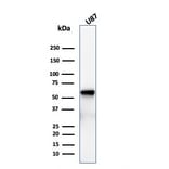 Western Blot - Anti-p75 NGF Receptor Antibody [rNGFR/1965] (A249498) - Antibodies.com