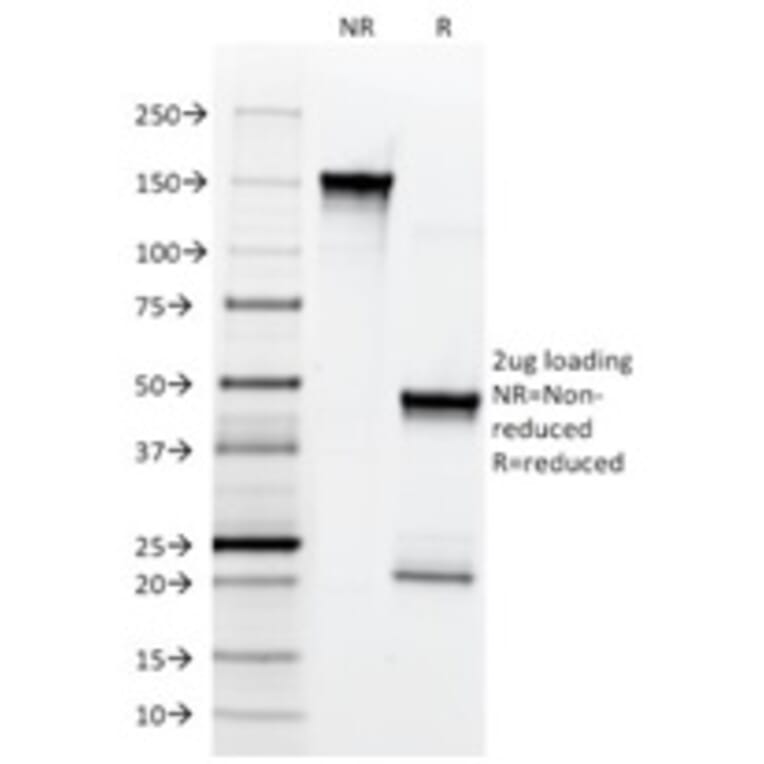 SDS-PAGE - Anti-p75 NGF Receptor Antibody [NGFR5] (A249499) - Antibodies.com