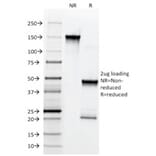 SDS-PAGE - Anti-p75 NGF Receptor Antibody [NGFR5] (A249499) - Antibodies.com