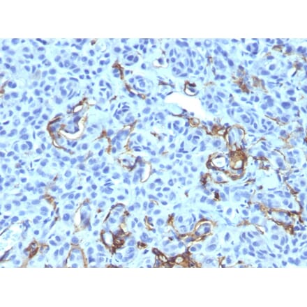 Immunohistochemistry - Anti-p75 NGF Receptor Antibody [NGFR5 + NTR/912] (A249502) - Antibodies.com
