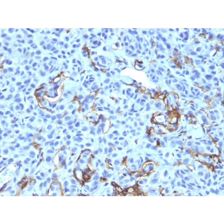 Immunohistochemistry - Anti-p75 NGF Receptor Antibody [NGFR5 + NTR/912] (A249502) - Antibodies.com