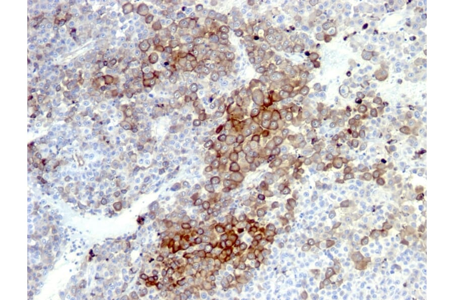 Immunohistochemistry - Anti-p75 NGF Receptor Antibody [NGFR5 + NTR/912] (A249501) - Antibodies.com
