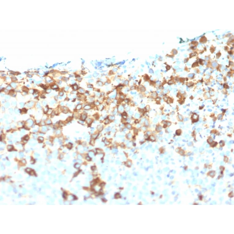 Immunohistochemistry - Anti-p75 NGF Receptor Antibody [NGFR/1964] (A249503) - Antibodies.com