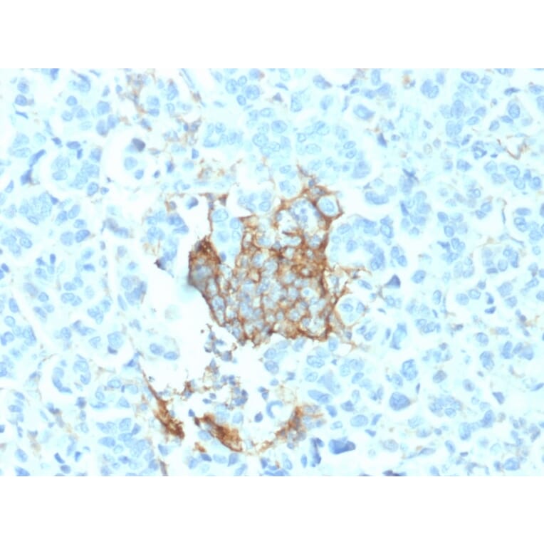 Immunohistochemistry - Anti-p75 NGF Receptor Antibody [NGFR/1964] (A249503) - Antibodies.com