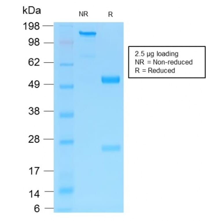 SDS-PAGE - Anti-p75 NGF Receptor Antibody [NGFR/1997R] (A249504) - Antibodies.com