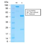 SDS-PAGE - Anti-p75 NGF Receptor Antibody [NGFR/1997R] (A249504) - Antibodies.com