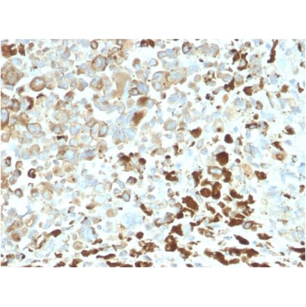 Immunohistochemistry - Anti-p75 NGF Receptor Antibody [NGFR/2550R] (A249504) - Antibodies.com