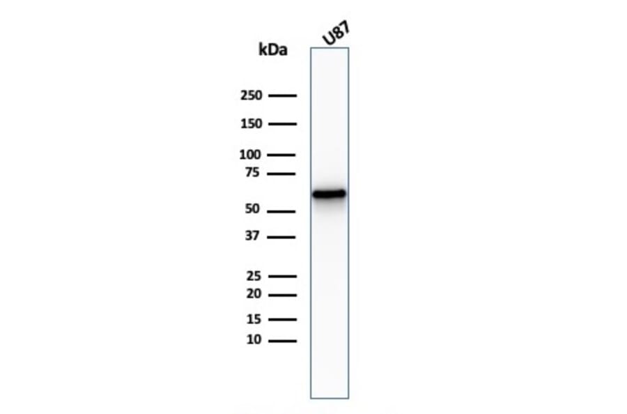 Western Blot - Anti-p75 NGF Receptor Antibody [NGFR/2550R] (A249505) - Antibodies.com