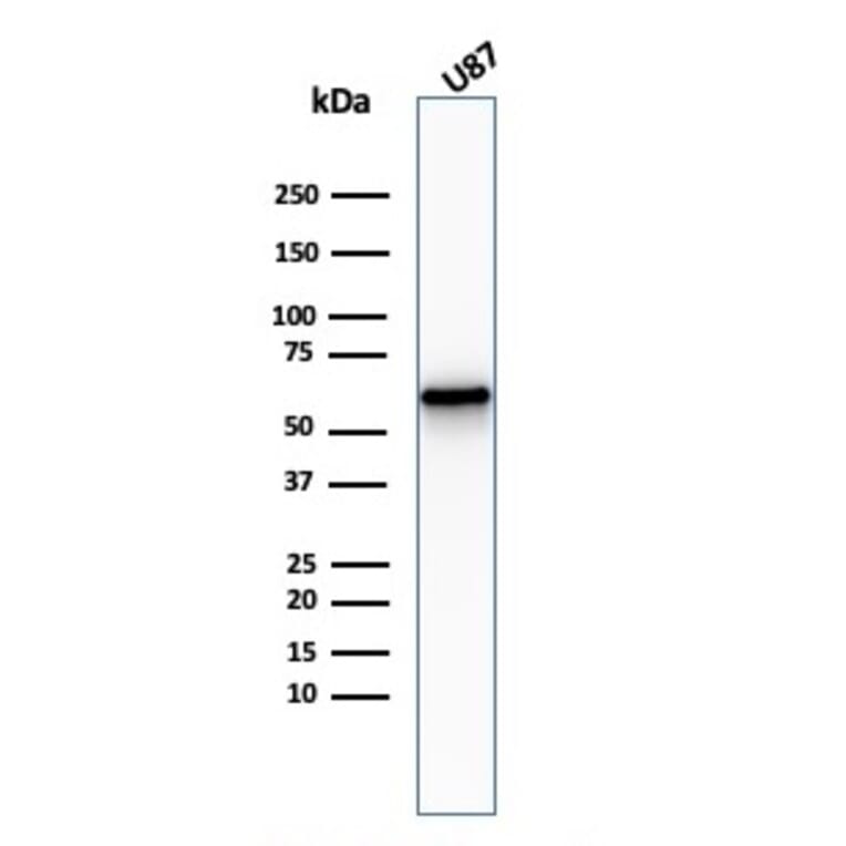 Western Blot - Anti-p75 NGF Receptor Antibody [NGFR/2550R] (A249505) - Antibodies.com