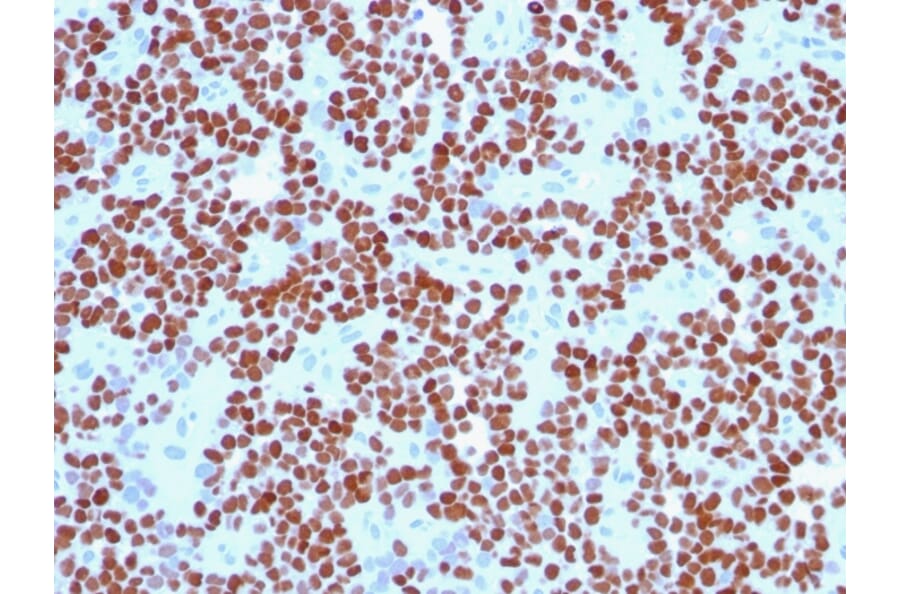 Immunohistochemistry - Anti-NKX2.2 Antibody [NX2/294] (A249505) - Antibodies.com