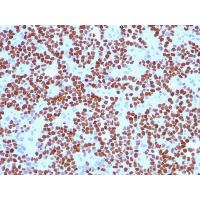 Immunohistochemistry - Anti-NKX2.2 Antibody [NX2/294] (A249505) - Antibodies.com