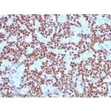 Immunohistochemistry - Anti-NKX2.2 Antibody [NX2/294] (A249505) - Antibodies.com