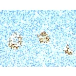 Immunohistochemistry - Anti-NKX2.2 Antibody [NX2/294] (A249506) - Antibodies.com