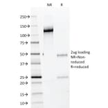 SDS-PAGE - Anti-NKX2.2 Antibody [NX2/294] (A249506) - Antibodies.com